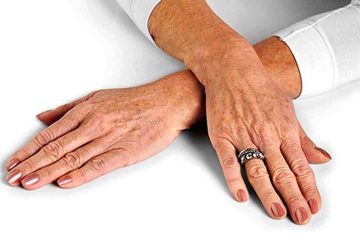 Hand skin age-related changes that require the use of rejuvenation techniques