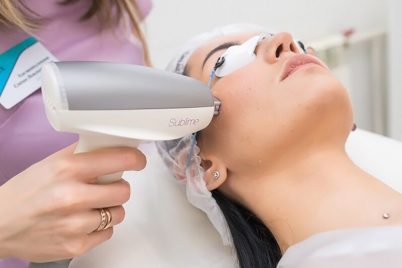 during a laser skin rejuvenation procedure